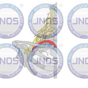 JNOS-ILL-003-0010